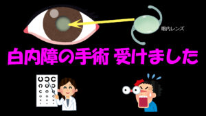 白内障の手術 受けました - 月と星空の探訪